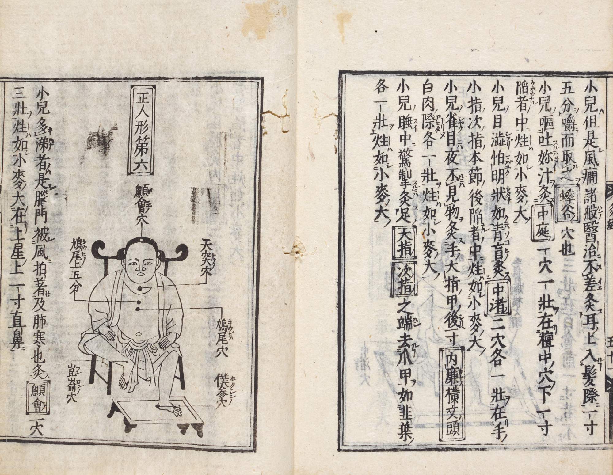The Newly Published Yellow Emperor's Book on Moxibustion (Shinkan kotei meido kyukei) | Edo period, 17th century