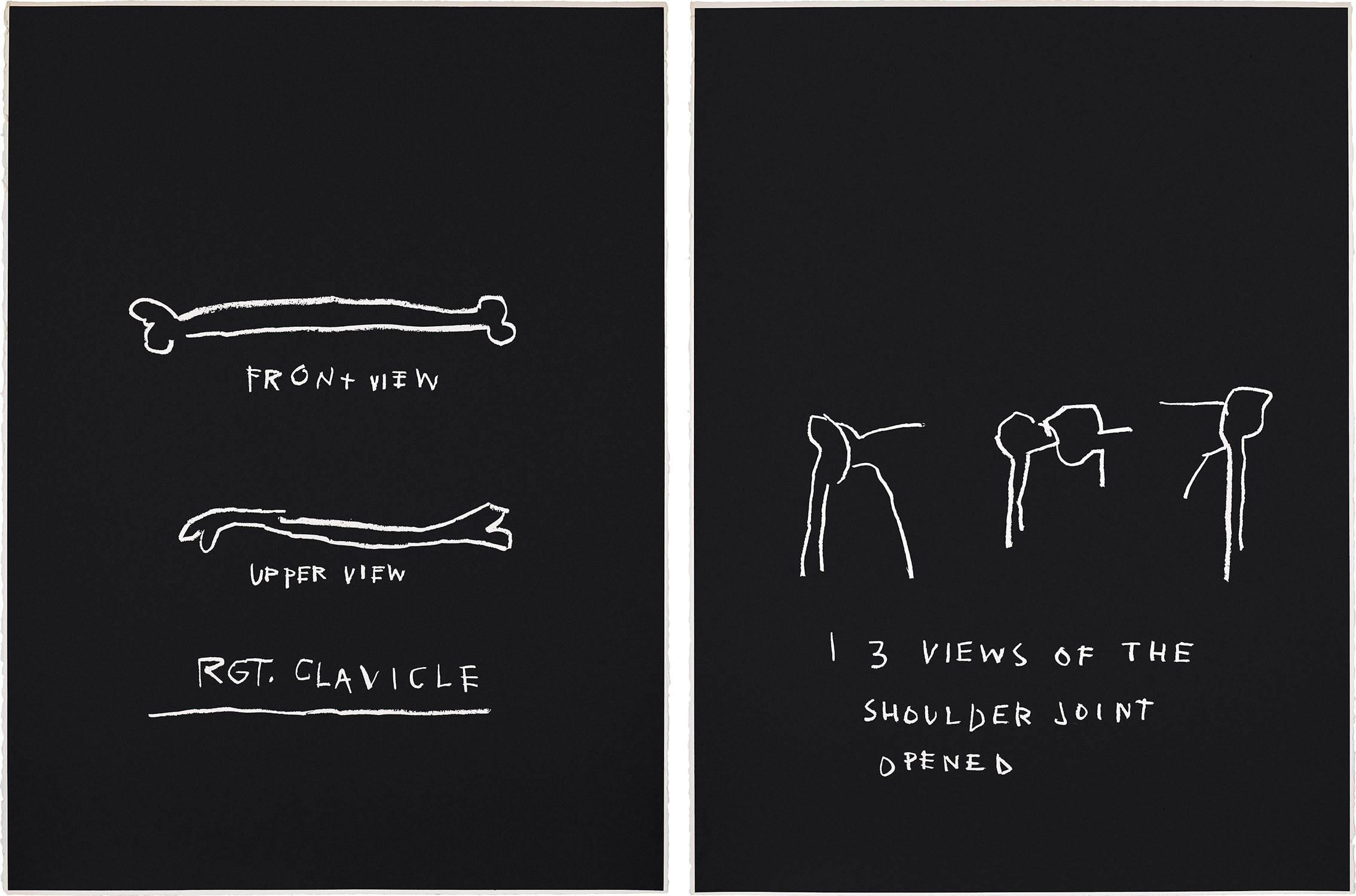Jean-Michel Basquiat — RGT Clavicle; and 3 Views of the Shoulder Joint Opened, from Anatomy