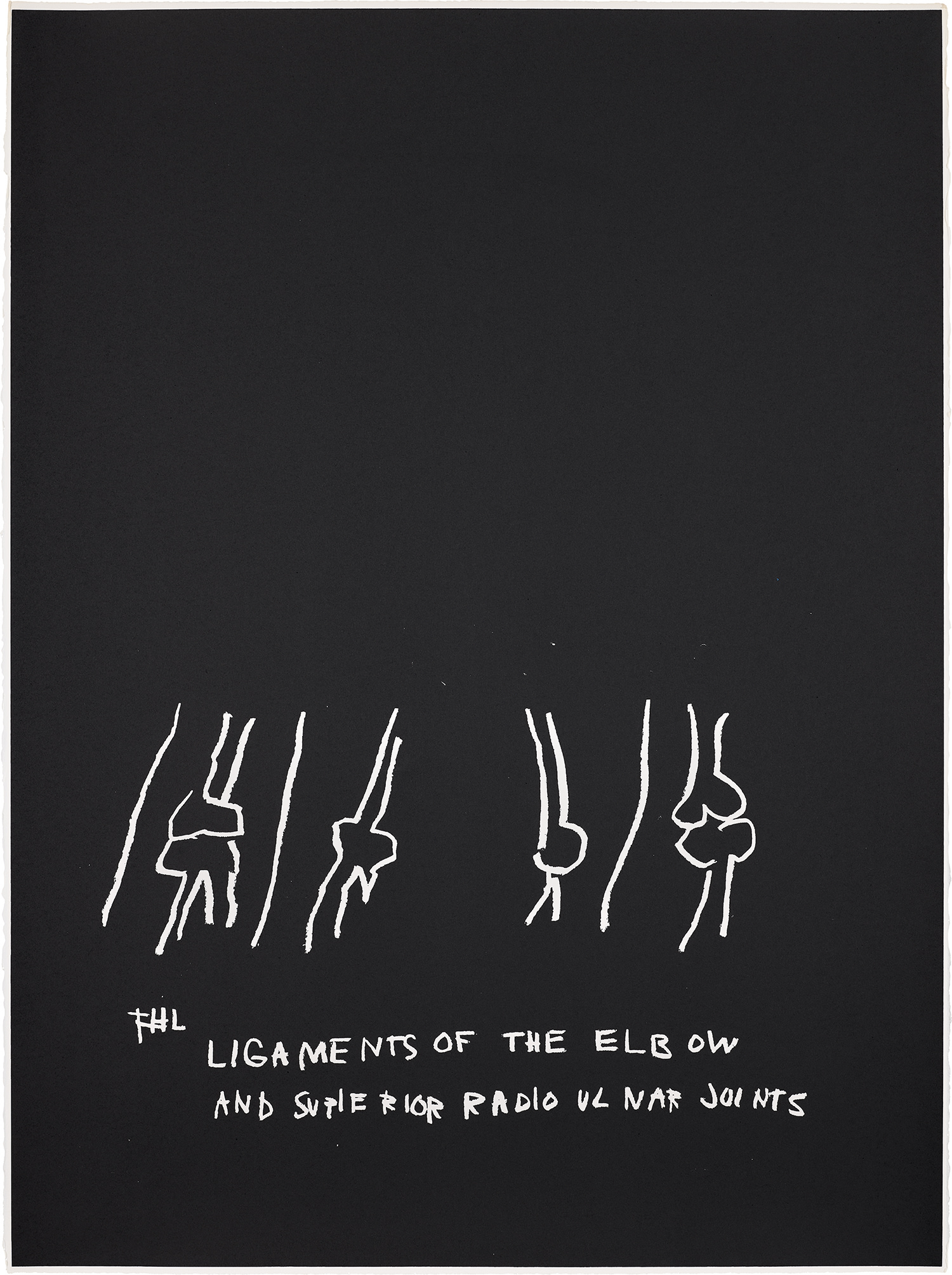 Ligaments of the Elbow, Etc., from Anatomy