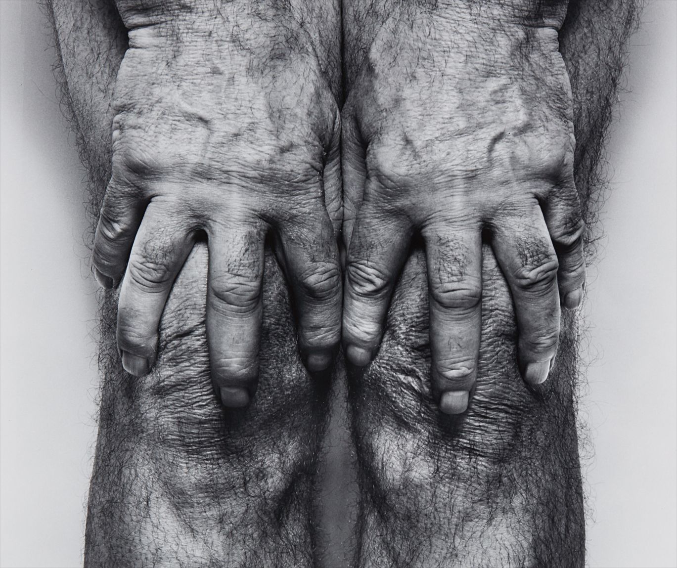 Self-Portrait (Hands spread on knees)