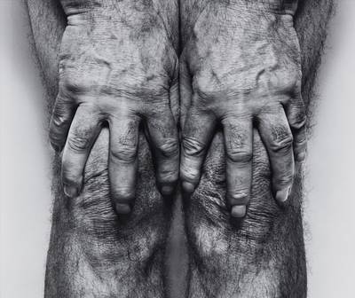 Self-Portrait (Hands spread on knees)