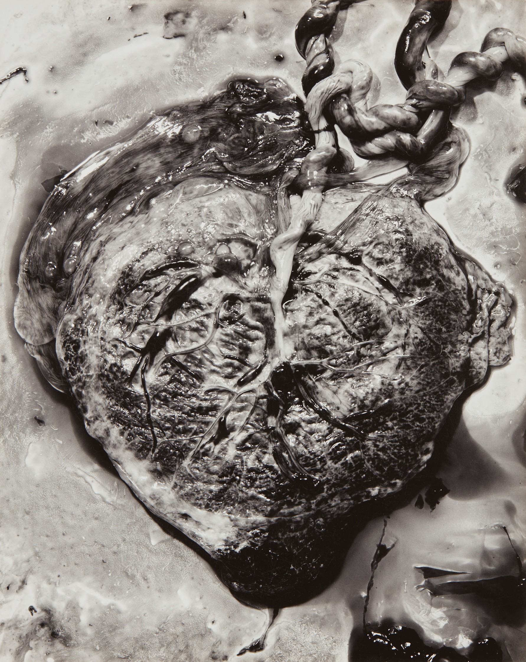 Frederick Sommer — Placenta