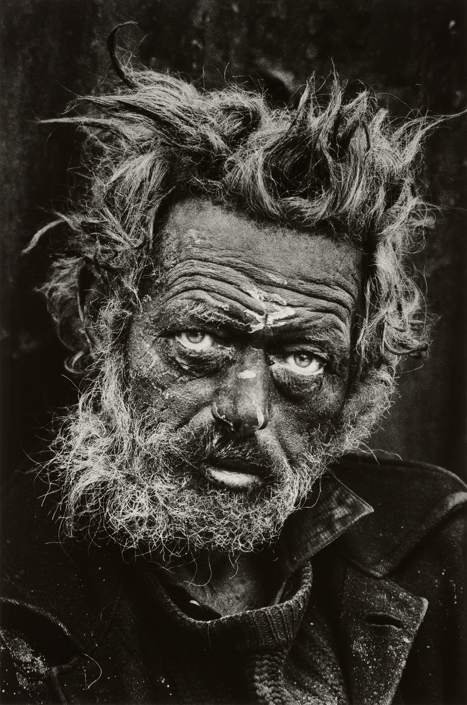 Tormented, Homeless Irishman, Spitalfields, London