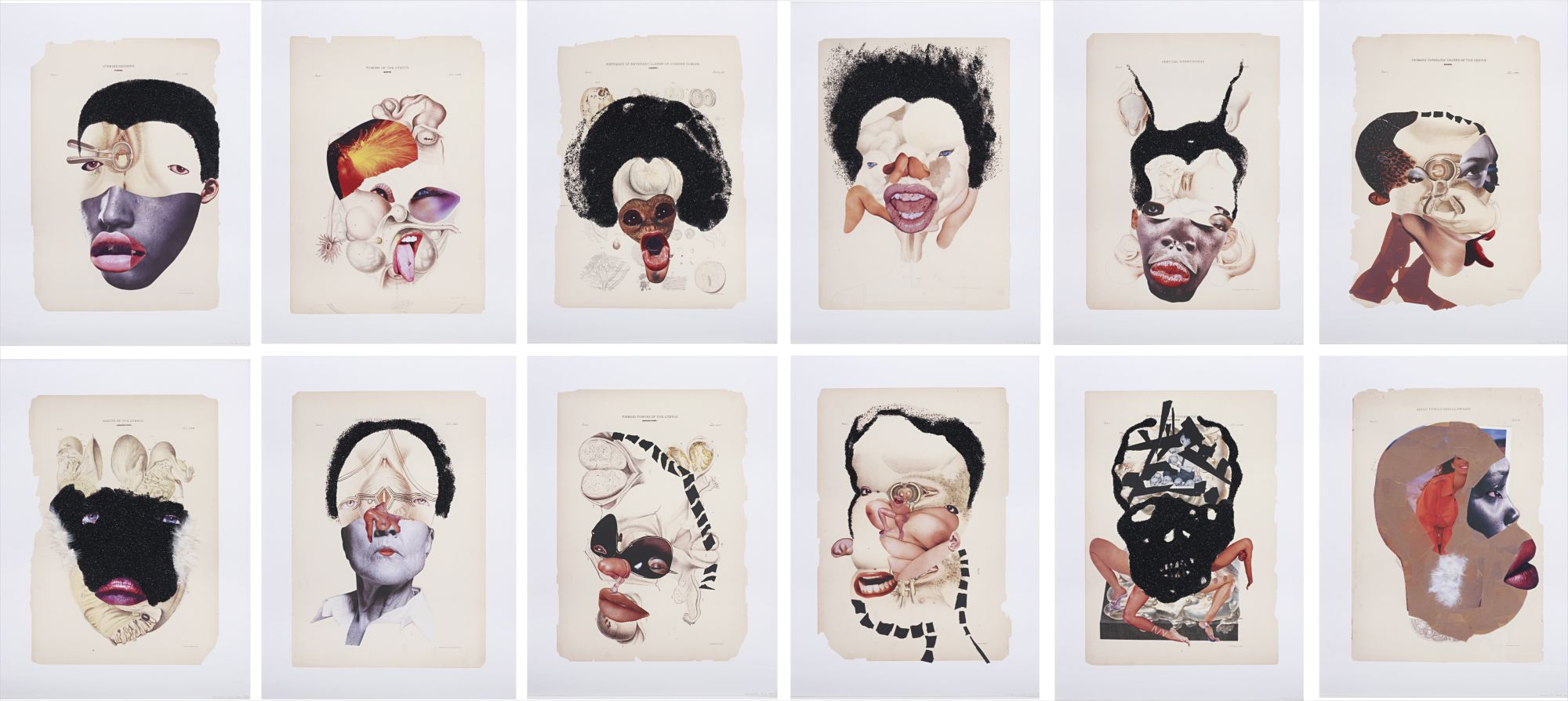 Histology of the Different Classes of Uterine Tumors