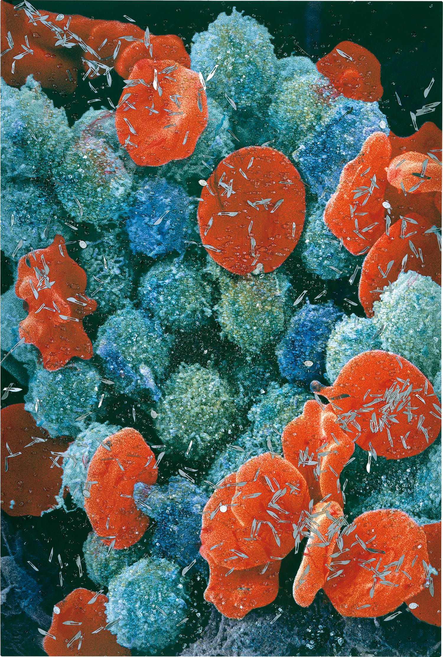 Damien Hirst — Second Series Biopsy: M132/655-Leukaemia_blood_cells,_scanning_electron_micrograph-SPL.jpg