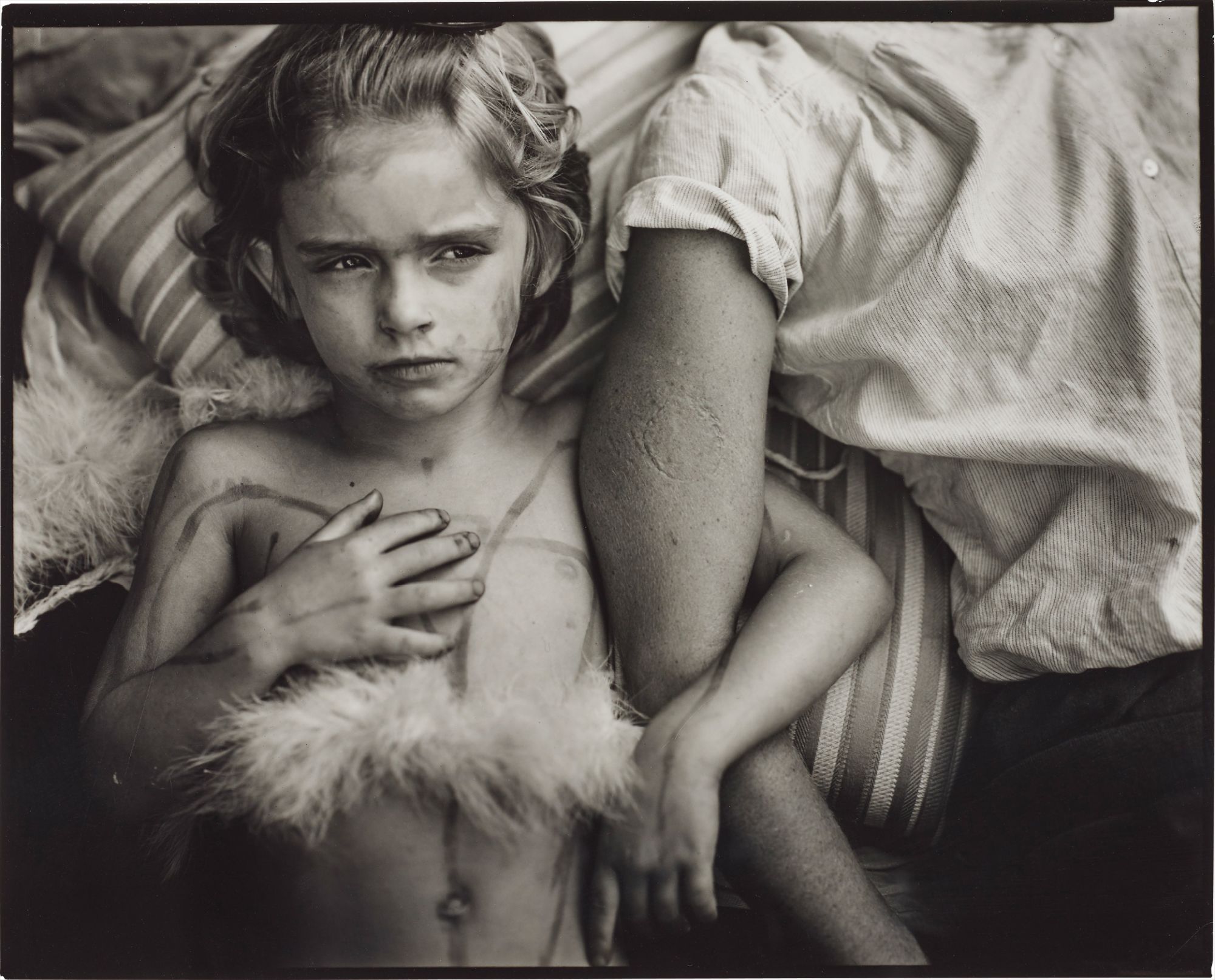 Sally Mann — Jessie Bites